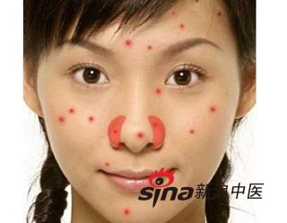 上火一夜爆发痘痘怎么办 推荐四种降火祛痘方